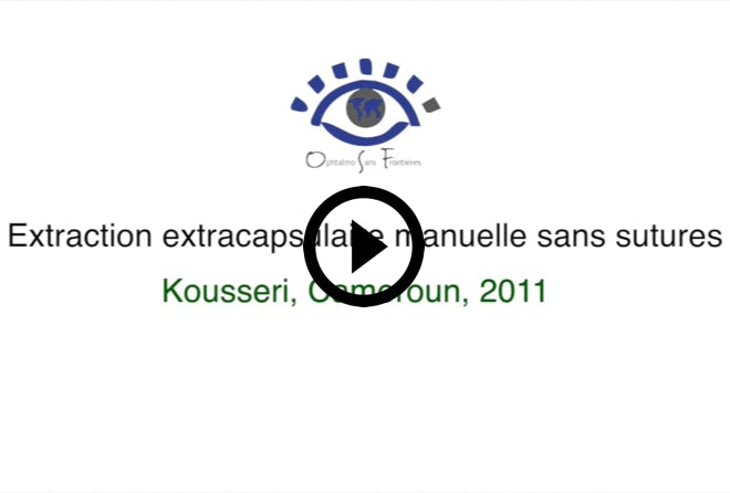 Lire la vidéo